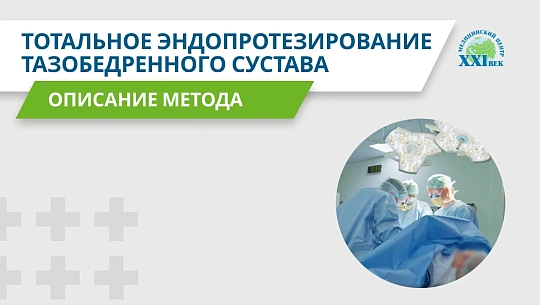 Тотальное эндопротезирование тазобедренного сустава